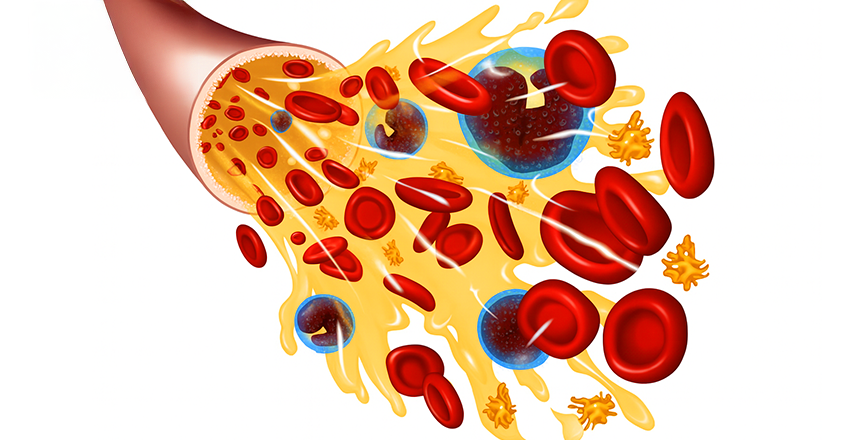 Фото - Кровь человека
