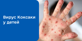 Картинка - Коксаки у детей: симптомы, лечение и фотографии сыпи