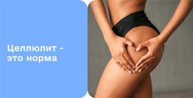 Картинка - Целлюлит: виды, симптомы и как избавиться