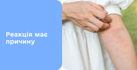 Картинка - Алергічний дерматит: симптоми, діагностика та лікування