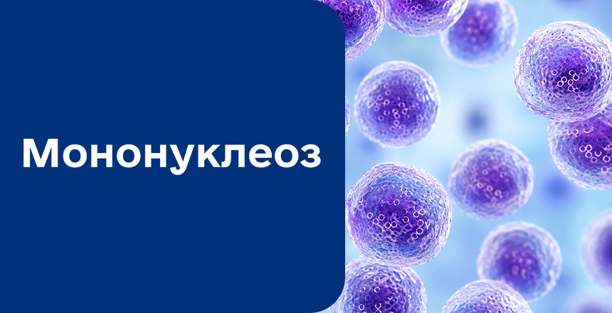 Фото - Мононуклеоз: возбудитель, симптомы и осложнения