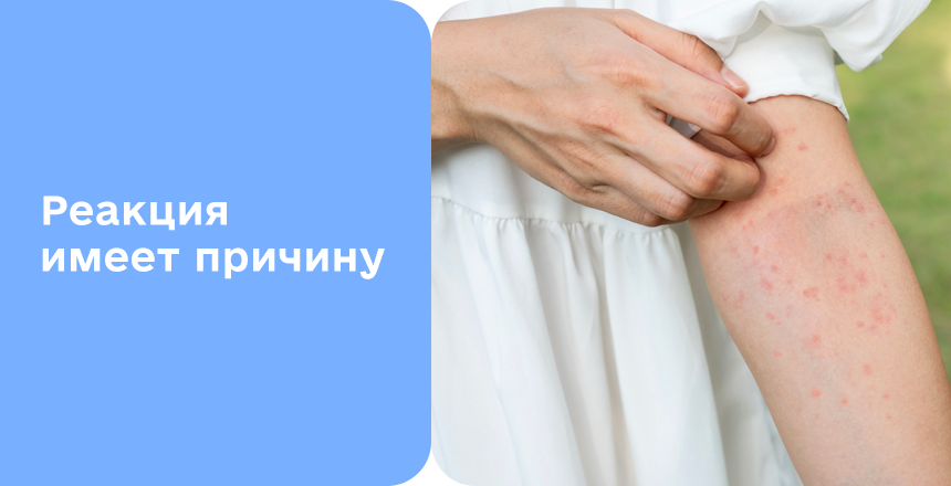 Фото - Аллергический дерматит: симптомы, диагностика и лечение