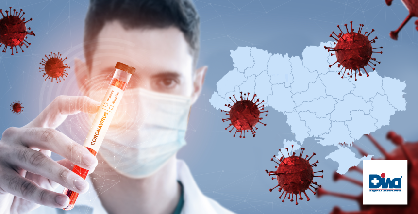 Фото - ДІЛА участвует в первом всеукраинском исследовании о распространенности COVID-19
