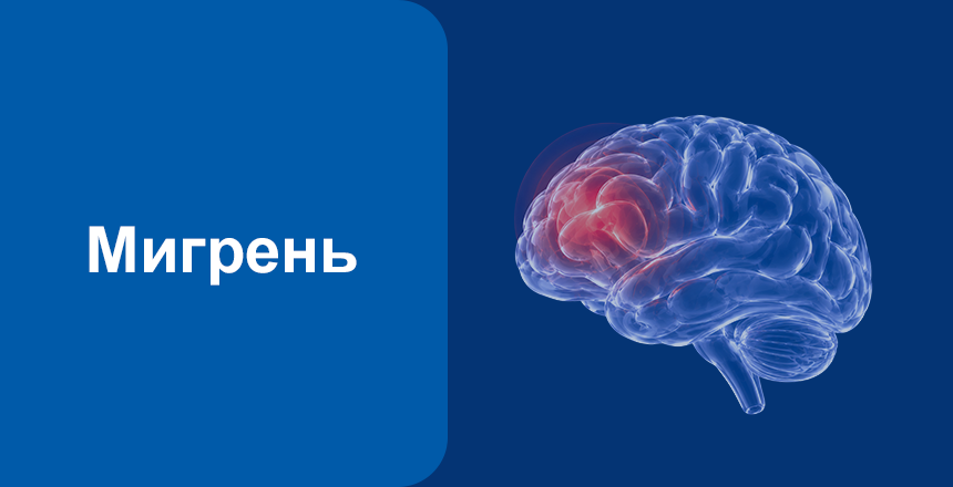 Фото - Мигрень: что это, причины, симптомы и лечение