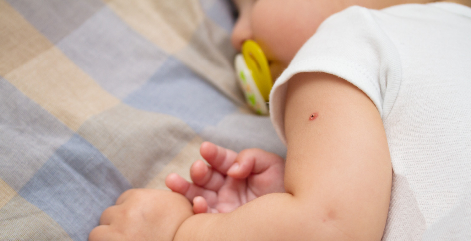 Фото - Ускладнення на вакцинацію БЦЖ як маркер імунодефіциту: які обстеження необхідно виконати в першу чергу