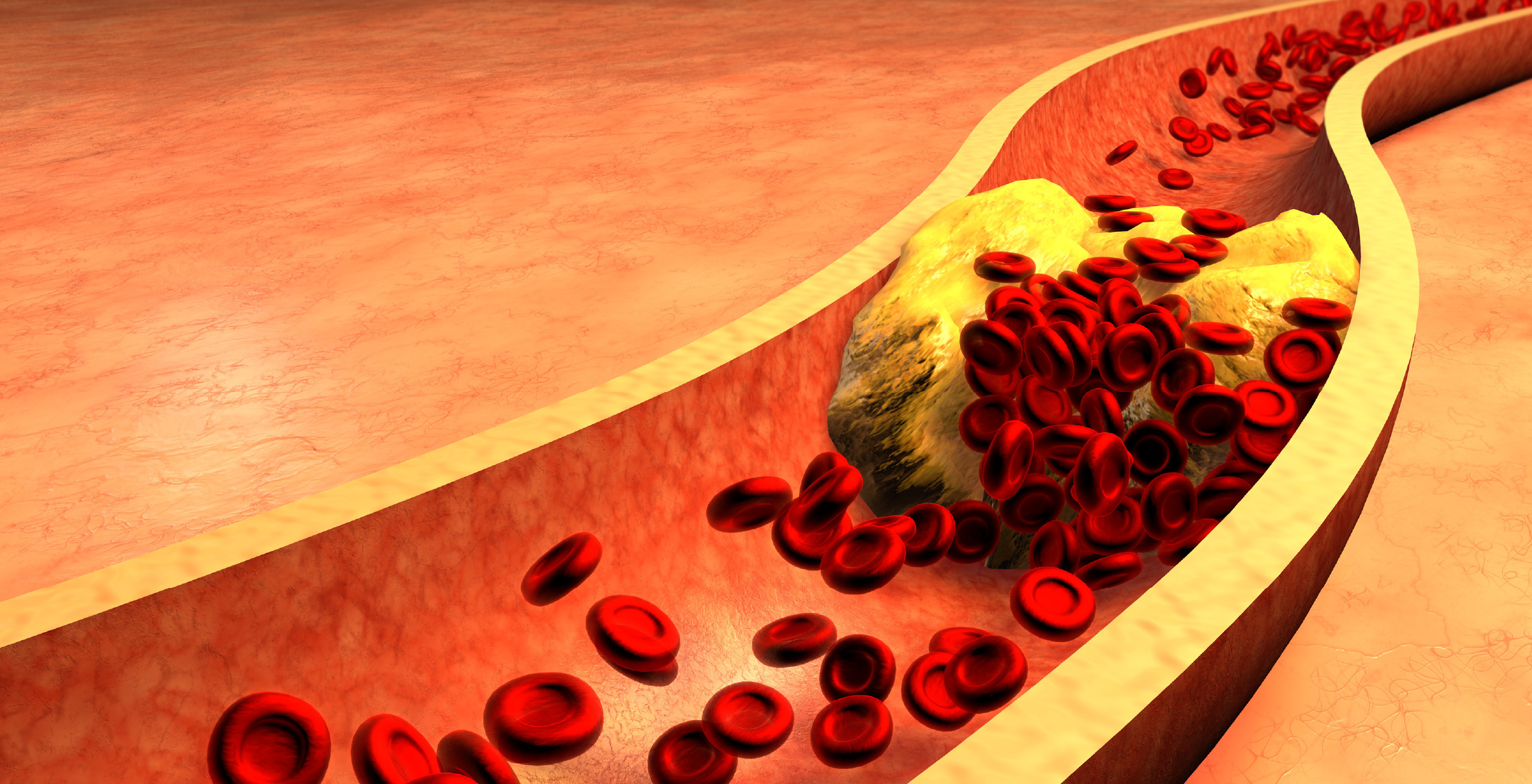 Фото - Визначення холестерину ліпопротеїдів низької щільності: переваги методів ДІЛА